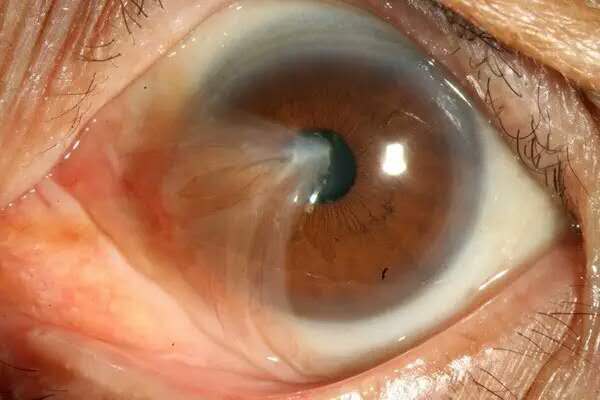 克罗恩病让这群年轻人痛不欲生_克罗恩病让这群年轻人痛不欲生_克罗恩病让这群年轻人痛不欲生