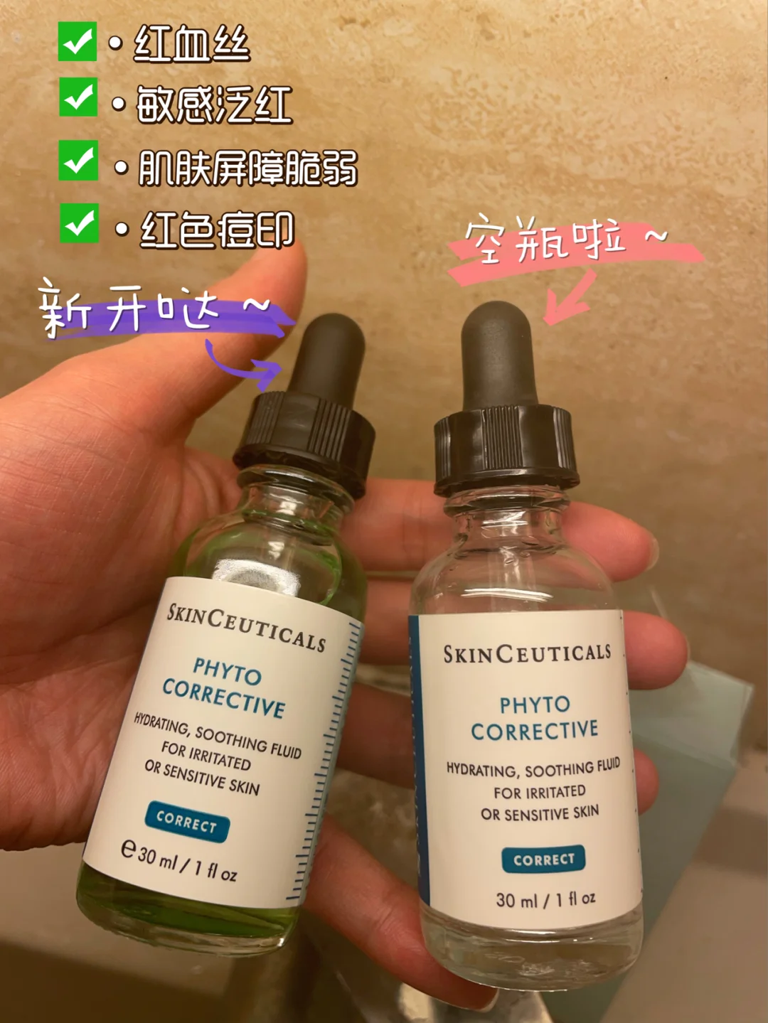 克罗恩病让这群年轻人痛不欲生_克罗恩病让这群年轻人痛不欲生_克罗恩病让这群年轻人痛不欲生