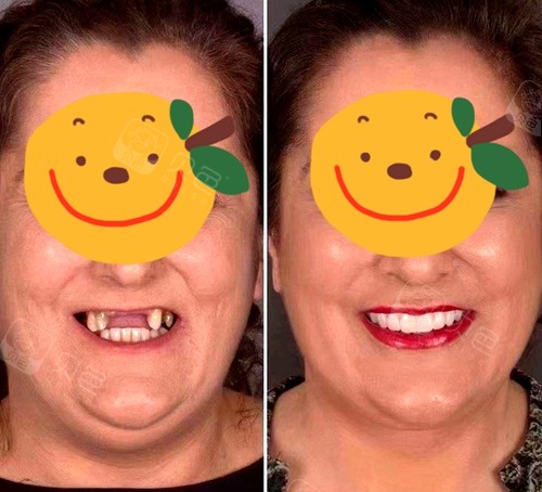 西安胃病医院好看的有哪些_西安哪个医院看胃病好_西安胃病医院好看吗