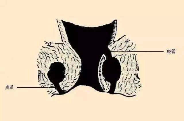失禁的肛门图片-关于尊严与失禁的故事：让人崩溃的生理现象与心理折磨