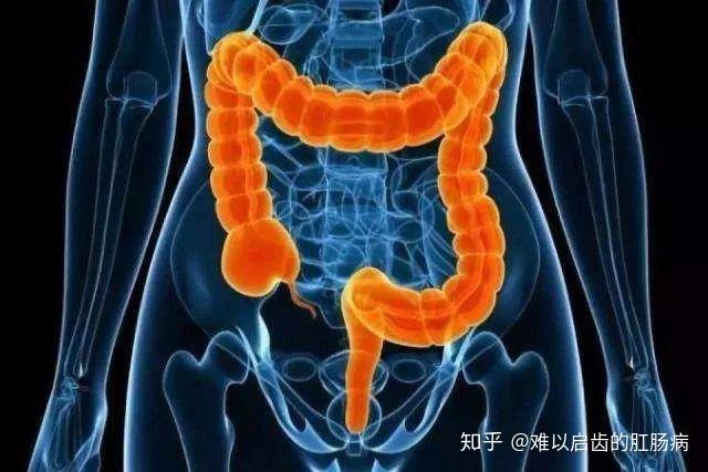 肛门失禁的案例-真实案例揭示肛门失禁的痛苦与尴尬，你了解多少？