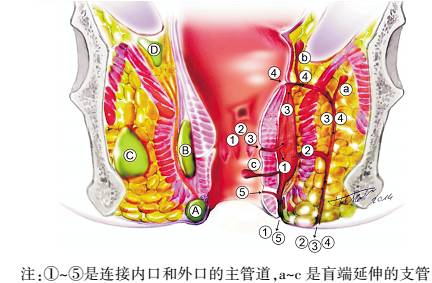 肛门病因失禁症状_肛门失禁病因_肛门病因失禁怎么治疗