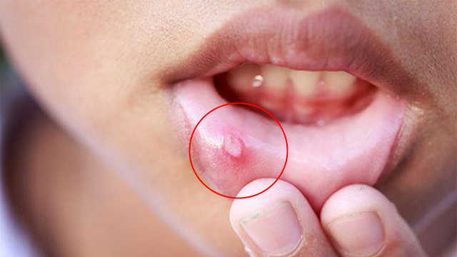 pear os安装-PearOS 安装指南：神秘果实般的操作系统，开启未知世界的冒险之旅