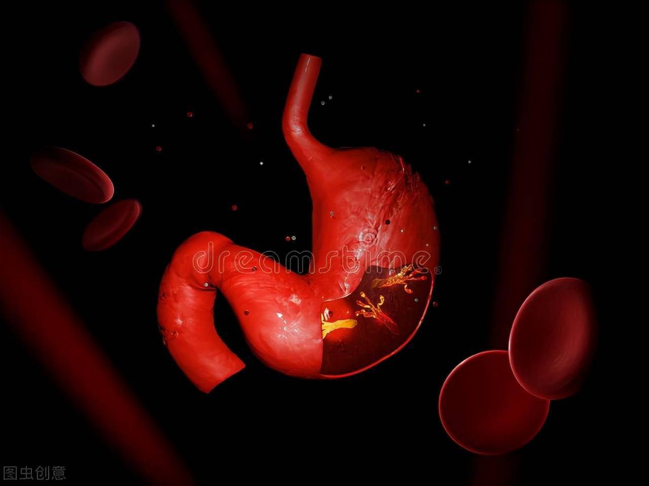 胃中医治疗方法溃疡怎么治疗_胃中医治疗方法溃疡效果好吗_胃溃疡中医治疗方法