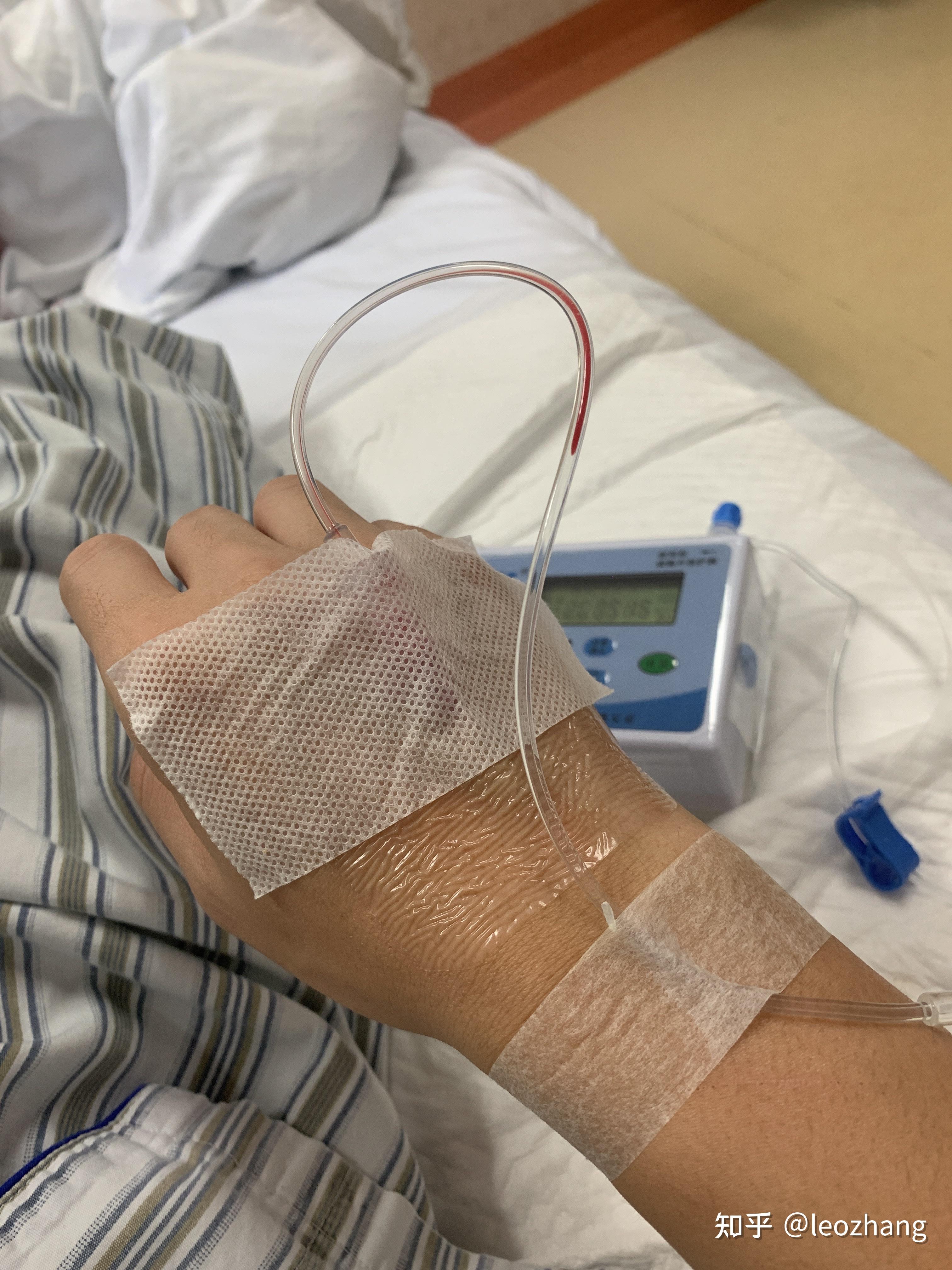 肛瘘手术住院时间-肛瘘手术住院记：痛苦与温暖交织的日子