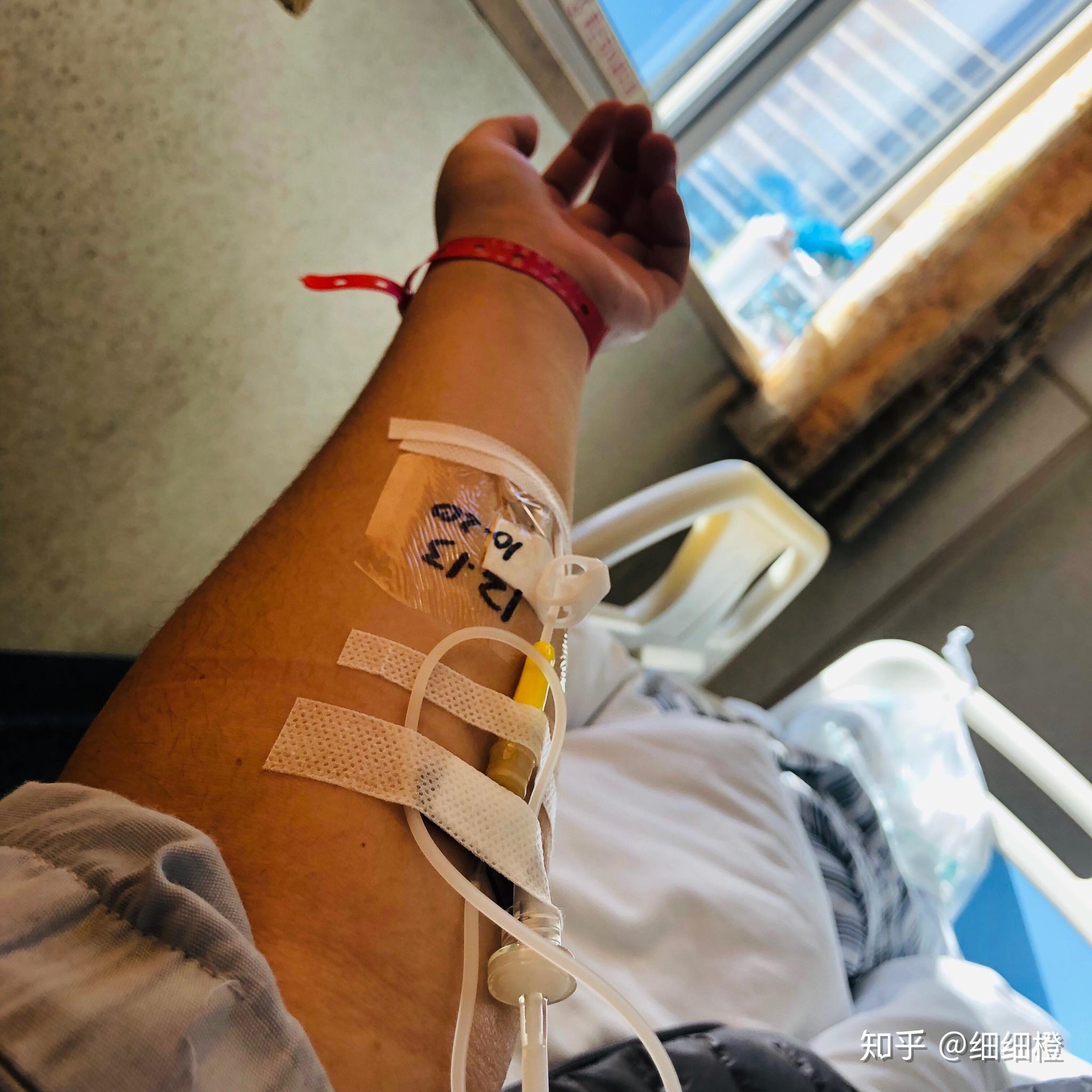 住院手术肛瘘时间多久_肛瘘术后住院多久_肛瘘手术住院时间