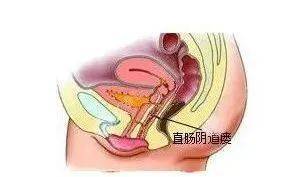 肛瘘手术时长_肛瘘手术时间_手术肛瘘时间多久