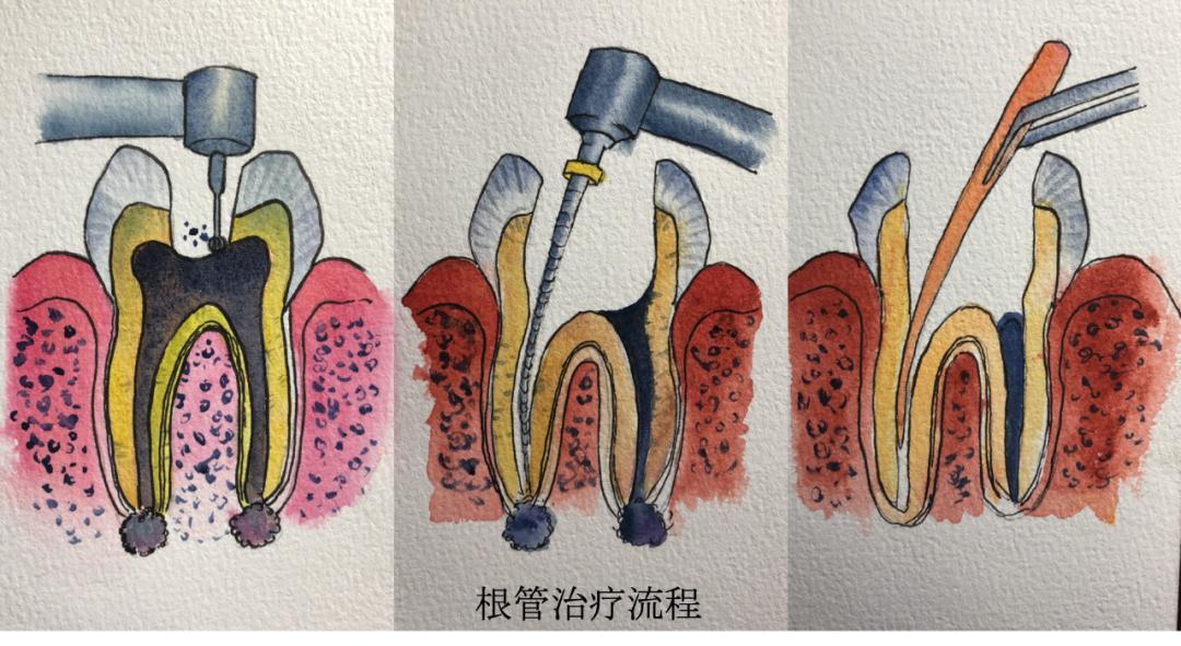人力资源专业术语缩写-揭开人力资源圈子里缩写的神秘面纱：HR、KPI 等你知道多少？