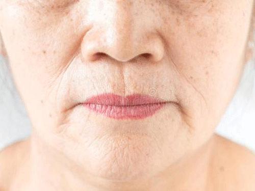 括约肌松弛_松弛括约肌是什么意思_松弛括约肌的药有哪些