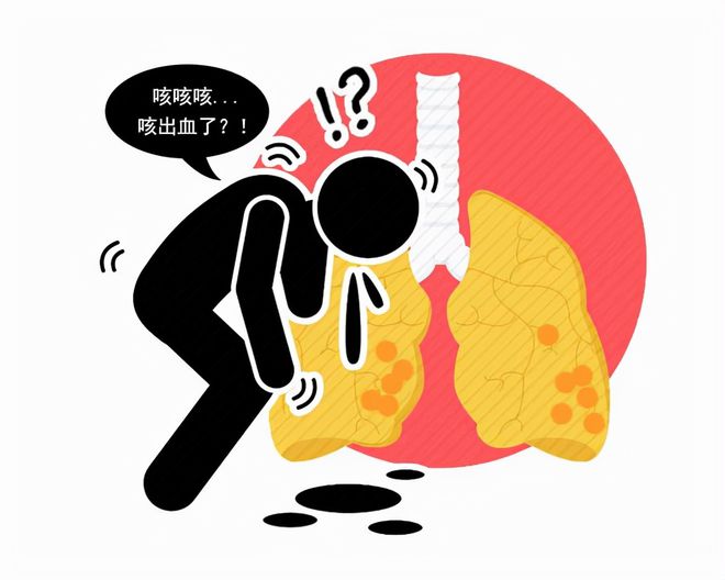 有肺结核的人死后会有传染性吗_肺结核三型会死人吗_肺结核死人会传染吗
