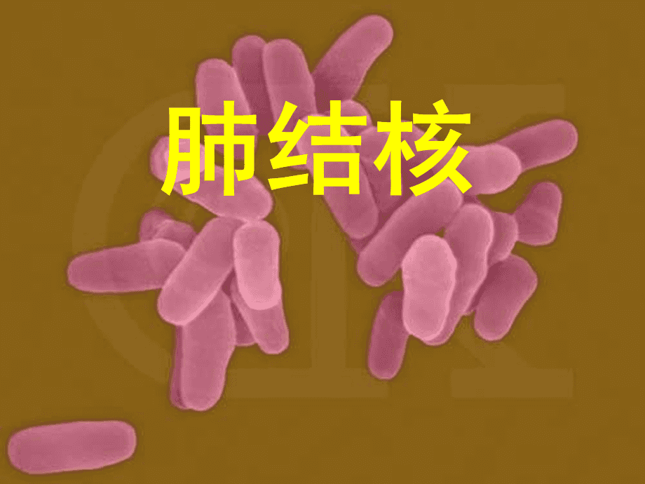 肺结核治愈后继发性_肺结核自愈性继发会传染吗_继发性肺结核会自愈吗