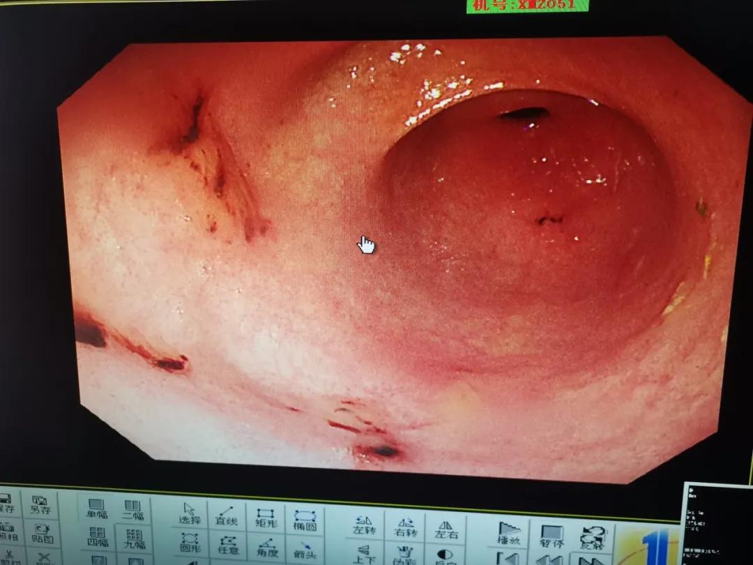 电池医生对手机有用吗_手机电池医生最新版下载_手机电池医生软件哪个好用