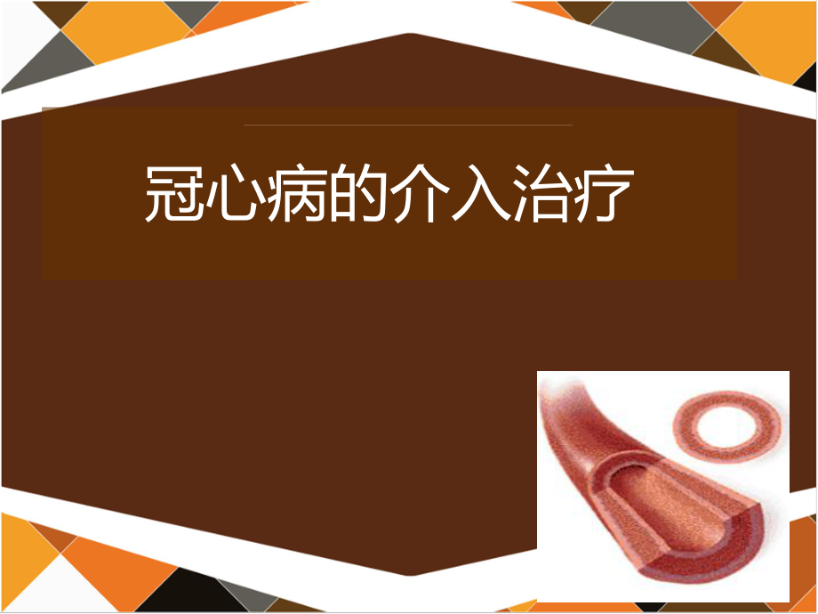 冠心病治愈大概多少钱_冠心病的四大治疗原则_冠心病 治疗