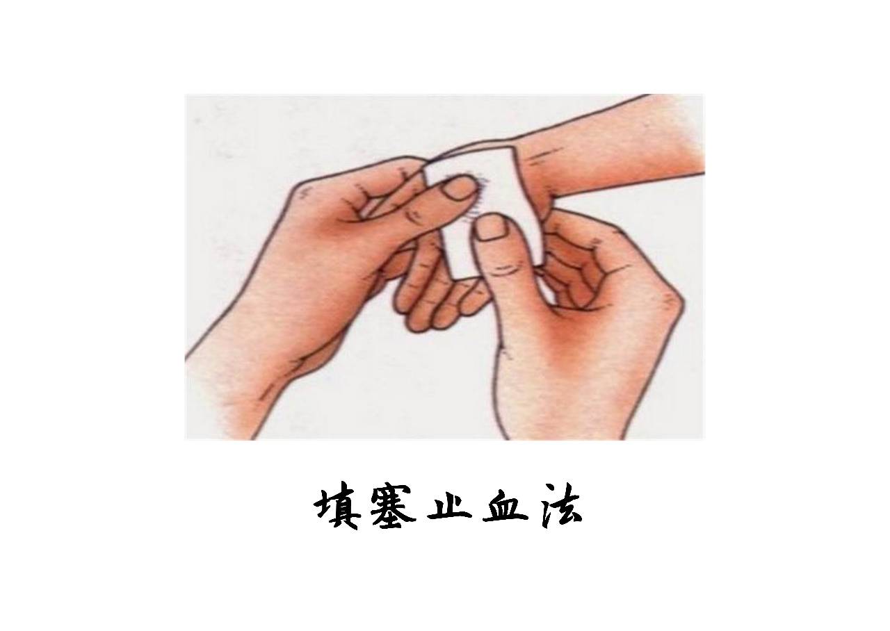 怎么恢复删除的短信_华为mate40短信删除恢复_短信删除恢复后在哪查看