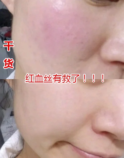 金山电池医生手机版_手机金山电池医生_金山电池医生手机版下载