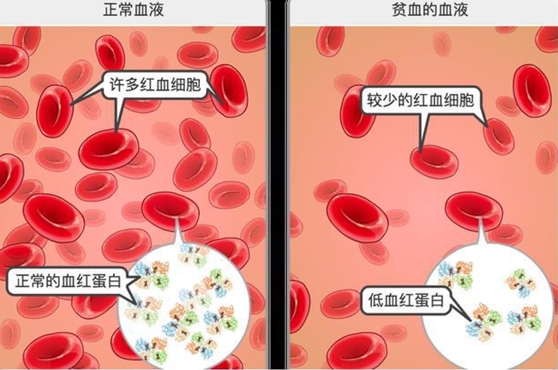 血液疾病的常见症状_血液疾病症状_血液症状疾病有哪些