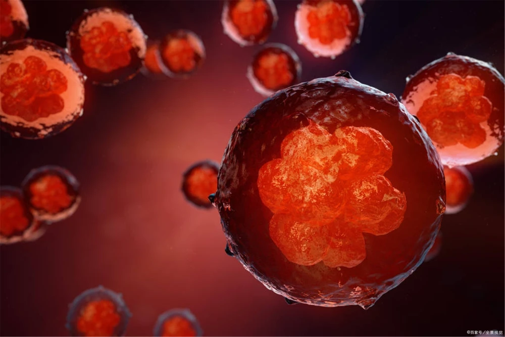 铁蛋白肺癌_肺癌铁蛋白_肺癌铁蛋白高是怎么回事