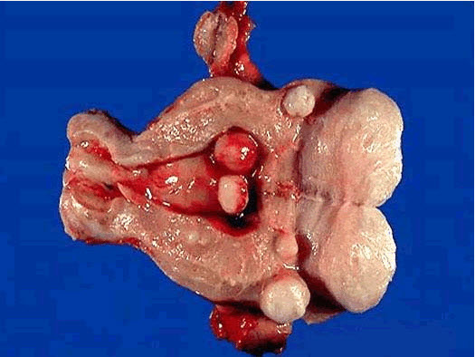 d e f盘消失了_c盘d盘e盘f盘是什么盘_d盘和f盘不见了