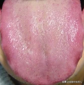 徐州哪个医院看新生儿肺炎好_徐州儿童医院看婴儿肺炎_徐州儿童医院插管治疗婴儿肺炎痰多怎么样?