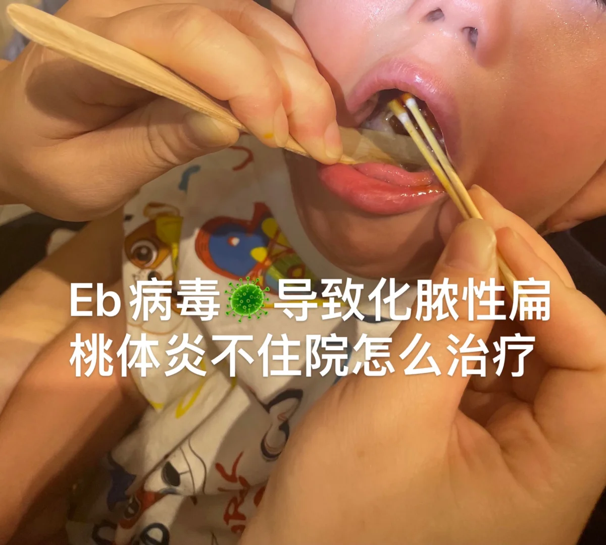 杀犇牛病毒来势汹汹，如何应对让人头疼