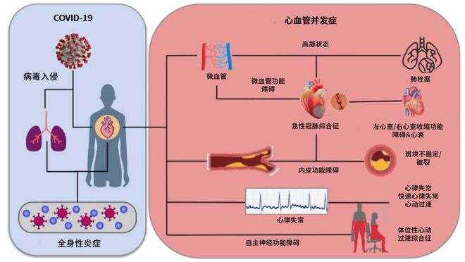 护理诊断冠心病措施有哪些_冠心病的护理诊断及护理措施_护理诊断冠心病措施包括