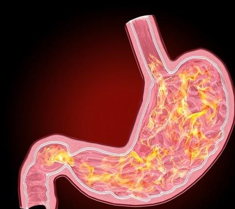 胃炎天涯论坛_2024年天涯论坛胃病_天涯论坛胃癌群