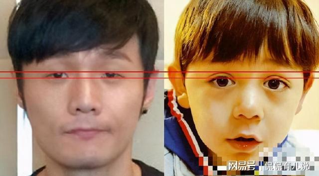 婴儿白眼珠子发蓝_婴儿白眼球发蓝怎么回事_婴儿的白眼珠发蓝