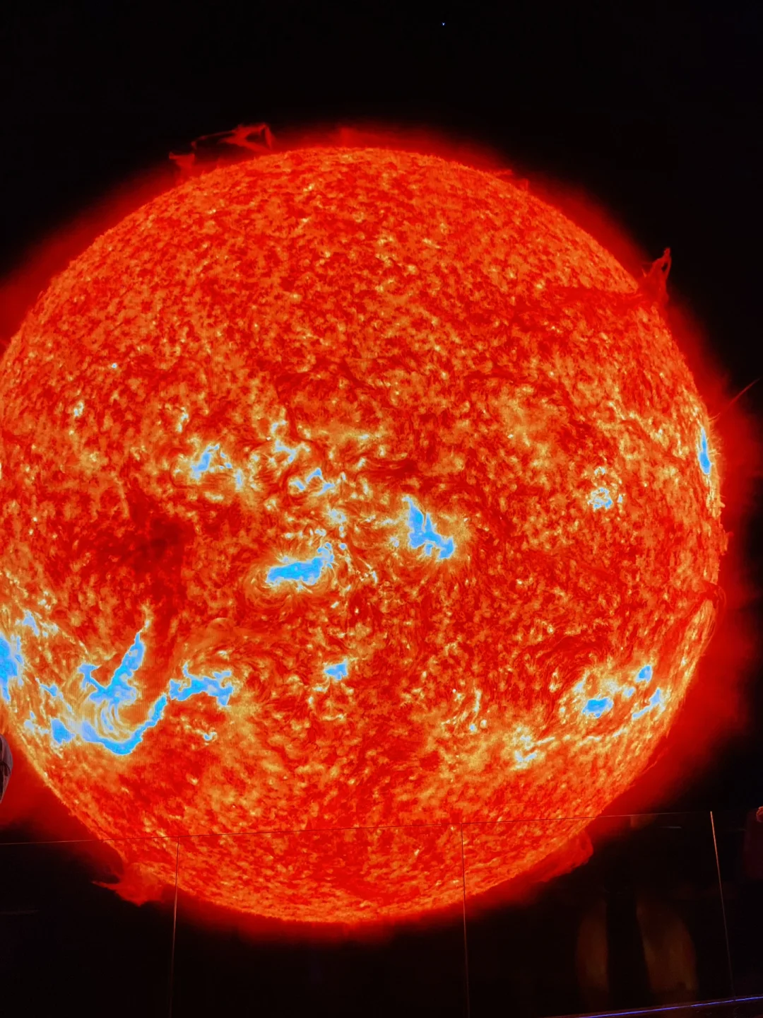 肺癌患者白蛋白还是球蛋白_白蛋白 肺癌_肺癌蛋白质