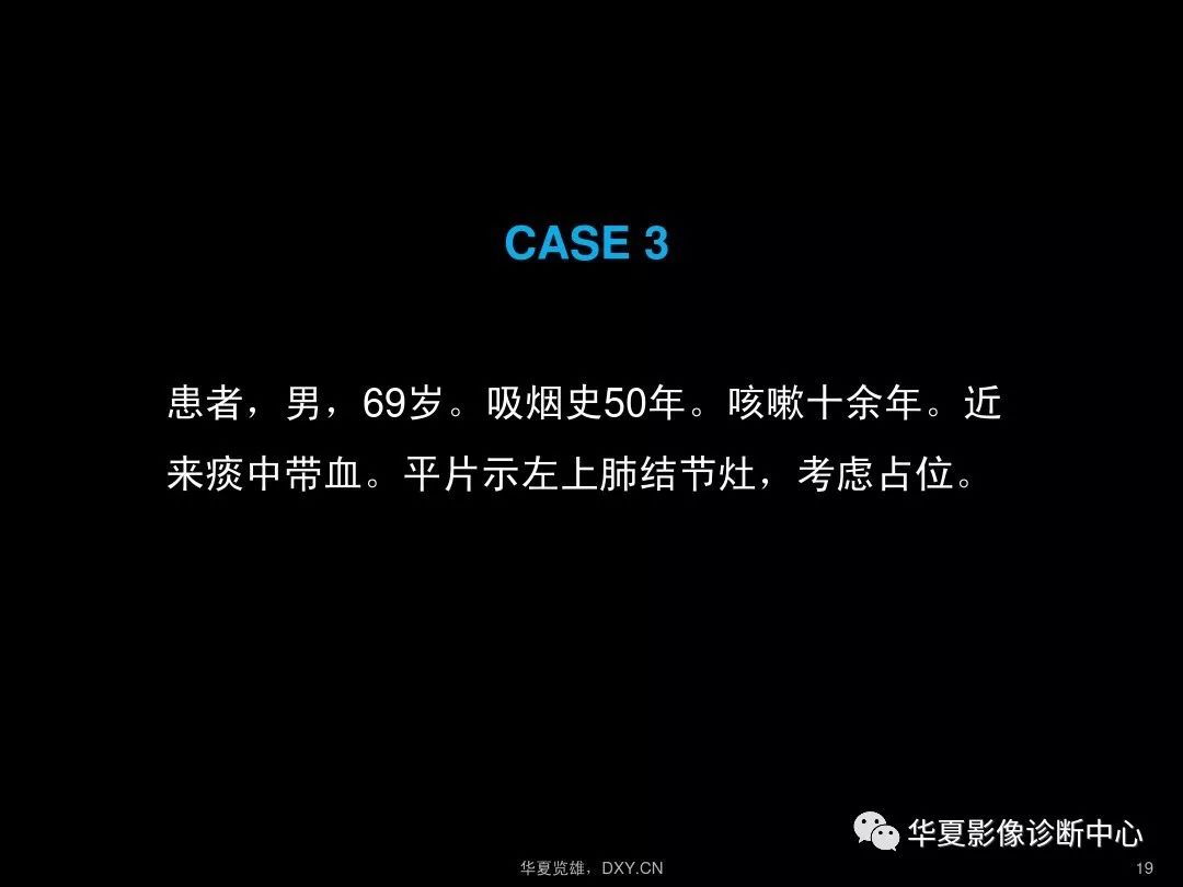 肺炎和肺结核哪个严重_肺炎结核病早期症状_肺炎加肺结核要治疗多久