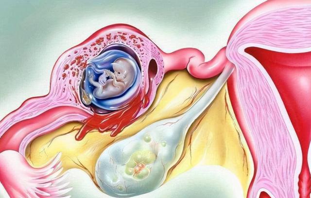 双桥医院产科怎么样_双桥医院流产_双桥医院产科