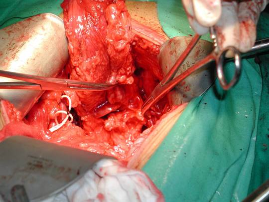 朝阳商丘评价医院有哪些_商丘朝阳医院评价怎样_商丘朝阳医院皮肤科怎么样