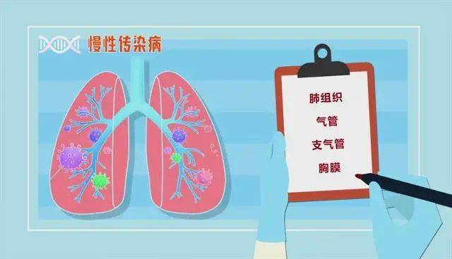 怎样会患上三型肺结核_结核会引起肺部感染吗_肺结核会引起其它病吗