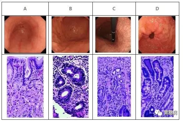 看胃病哪家医院好_胃病医院哪家效果好_看胃病医院排名