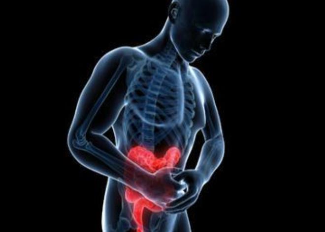 克罗恩中医治疗原则_克罗恩病/中西医结合疗法_克罗恩的中医疗法