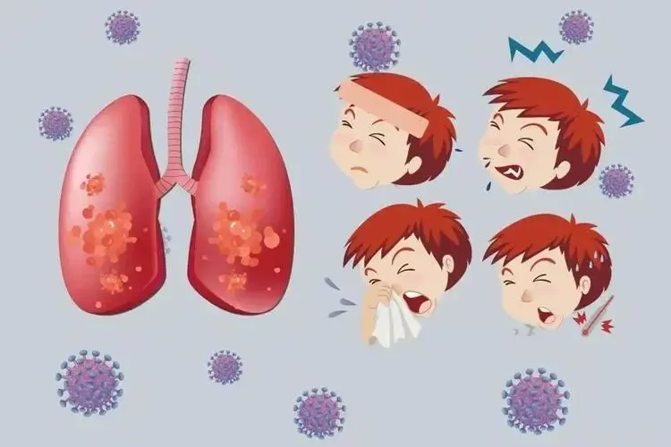 呼吸道合胞病毒 图片_呼吸合胞病毒表现_呼吸合胞病毒见于什么病