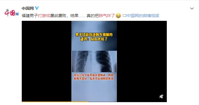 严重气胸有生命危险吗_严重气胸的症状_气胸严重吗