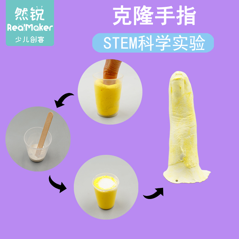 罗克恩病早期症状_罗克罗恩病_克罗恩病克罗恩肠炎治疗
