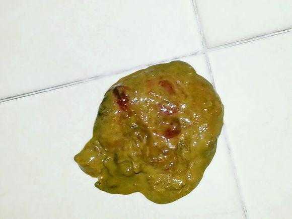 排大便出血是怎么回事_出血大便排回事是痔疮吗_出血大便排回事是什么原因