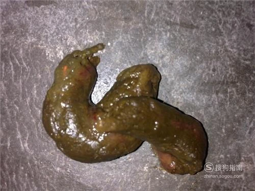 出血大便排回事是什么原因_出血大便排回事是痔疮吗_排大便出血是怎么回事