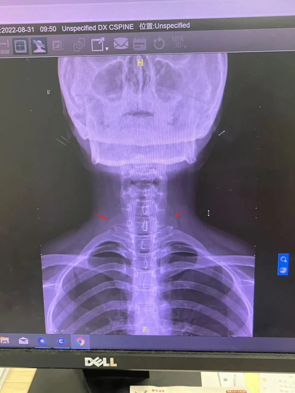 xvidcoredll win7 64_xvidcoredll win7 64_xvidcoredll win7 64