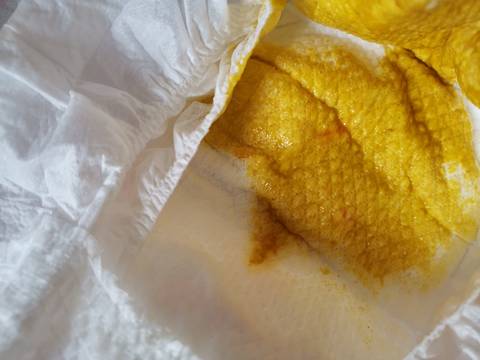 拉大便时只拉出鲜血_拉大便拉出鲜血_大便时拉出血来