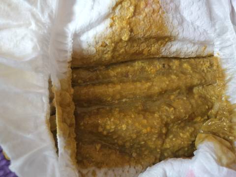 大便时拉出血来_拉大便拉出鲜血_拉大便时只拉出鲜血