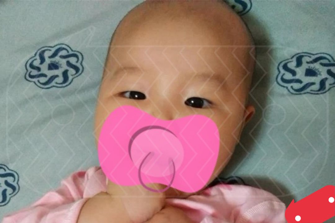 婴儿白眼珠子发蓝_婴儿白眼球蓝色_婴儿白眼球发蓝怎么回事