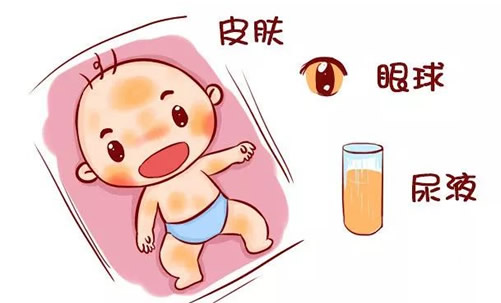 婴儿白眼球发蓝怎么回事_婴儿白眼球蓝色_婴儿白眼珠子发蓝