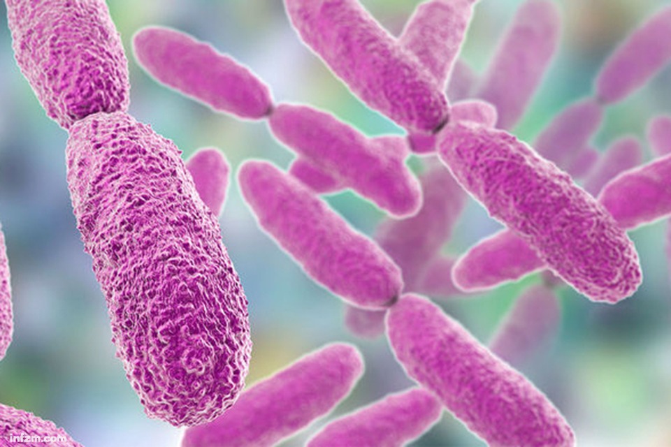 克雷白杆菌肺炎：身体里的无形恶魔，肺部的严峻考验