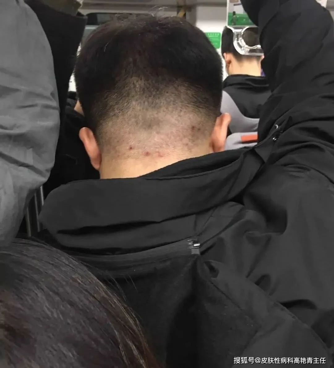 北京佑安医院挂号电话：让我又爱又恨的就医之路