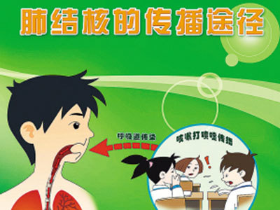 继发性肺结核要隔离吗_肺隔离结核性继发要治疗吗_肺隔离结核性继发要治疗多久