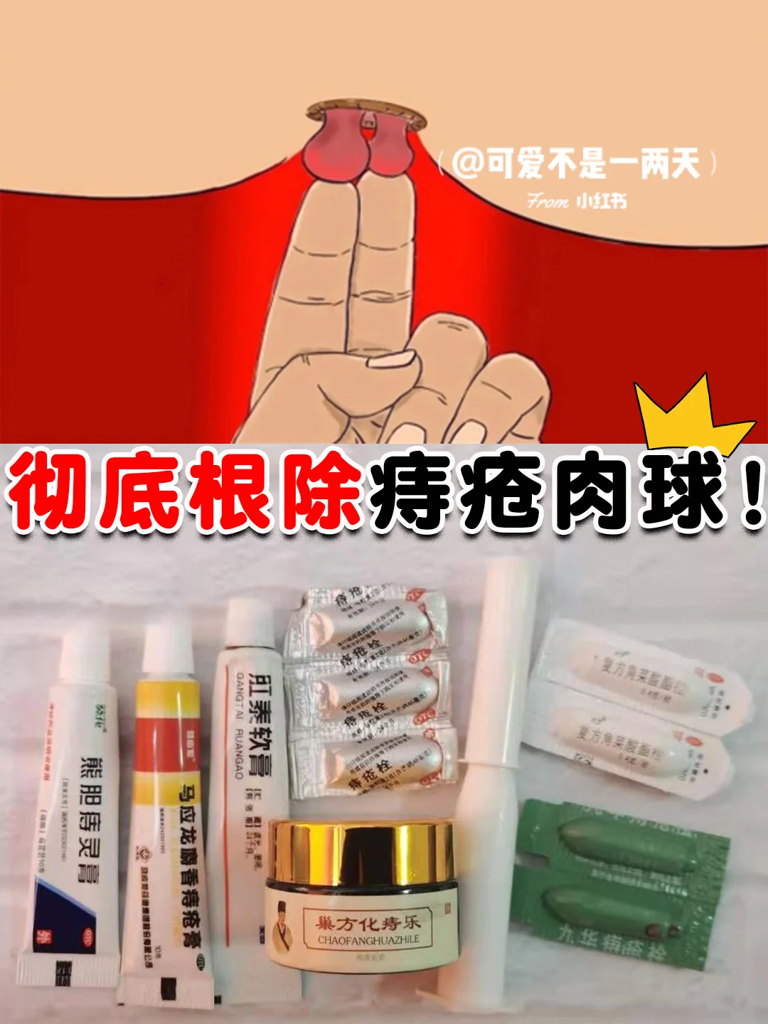 肛门漏气可以自愈吗_肛门轻度漏气失禁怎么治疗_肛门轻度失禁肛门漏气