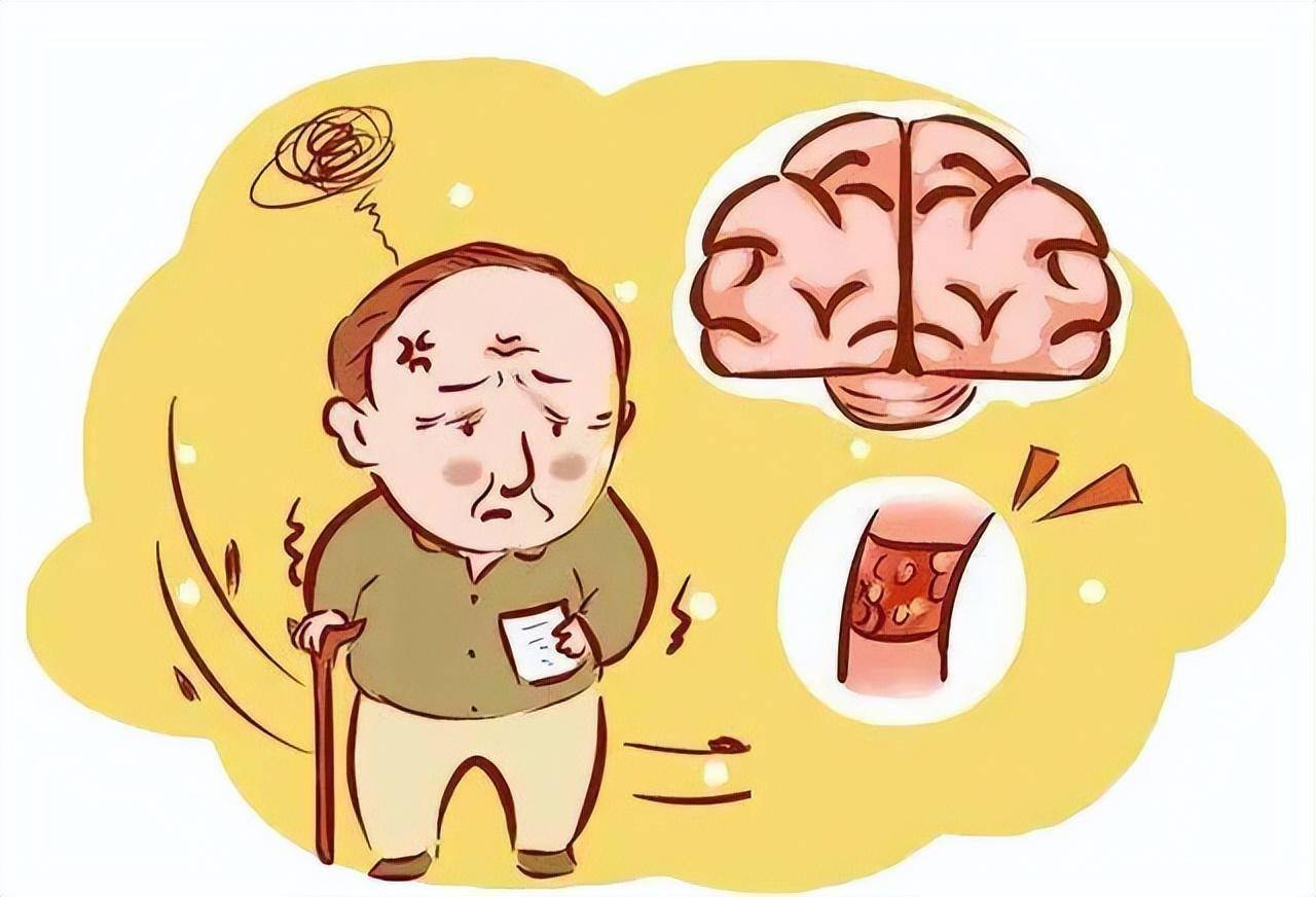 进展式卒中怎么治疗_进展性卒中时间节点_进展性卒中是什么意思