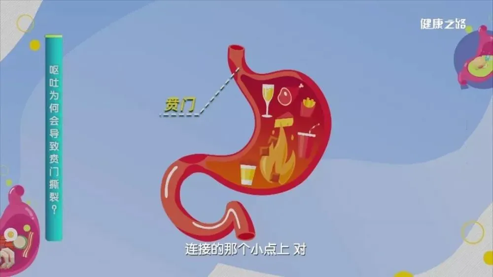 胃健康之路_胃病视频讲解_健康之路胃病视频全集